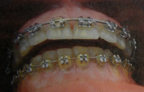 Caso 2 foto 2