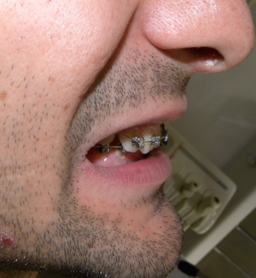 Caso 3 foto 4