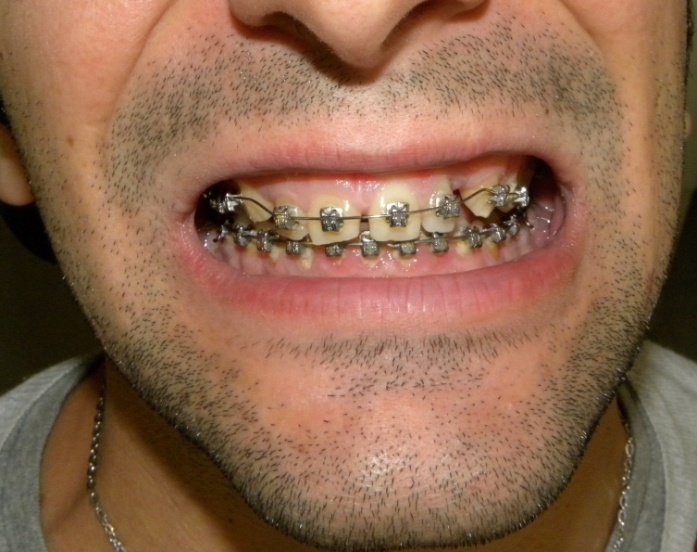 Caso 3 foto 5